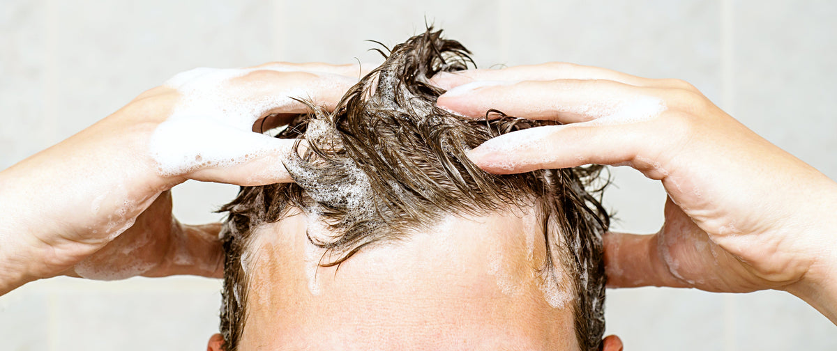 What Is Dandruff? And What Do I Do About It?