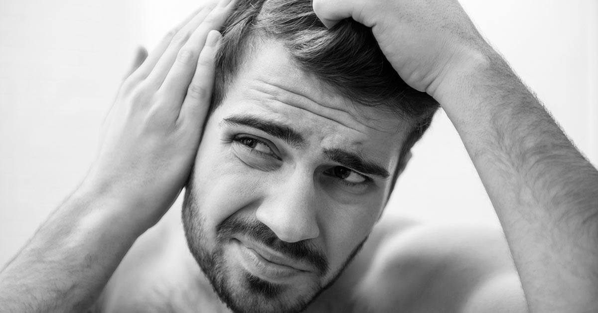 5 Steps: How to Combat Receding Hairlines [Thinning Hair]